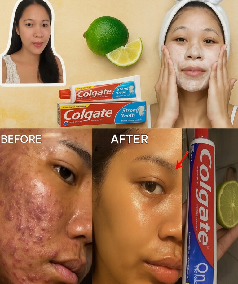 Here’s how to brighten your face with the secret combination of lemon and Colgate toothpasteThe method 