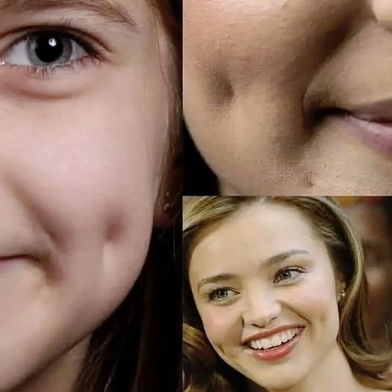 The secret meaning of dimples that most people don’t know about